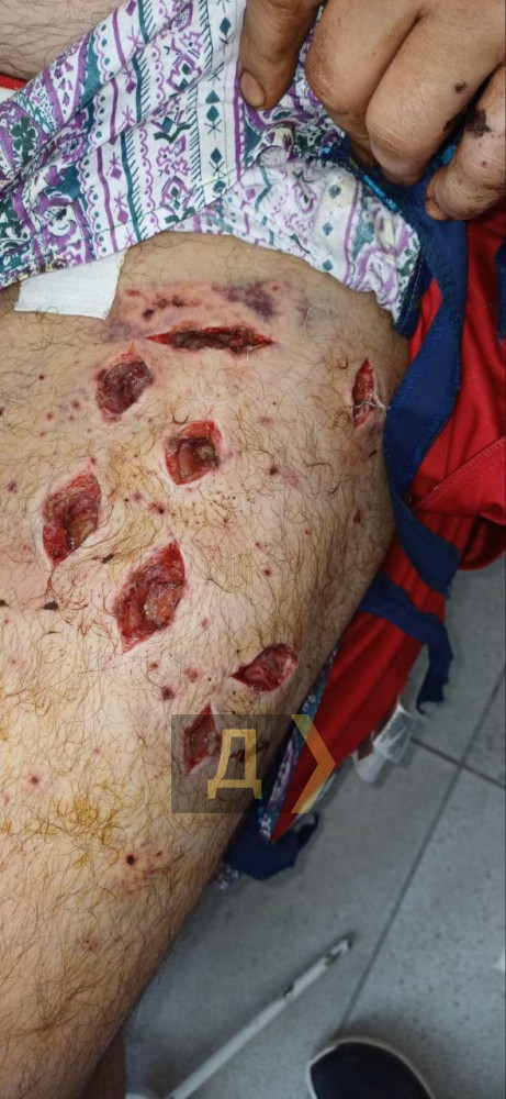 ���� �������� ����� ��� ��� �����������