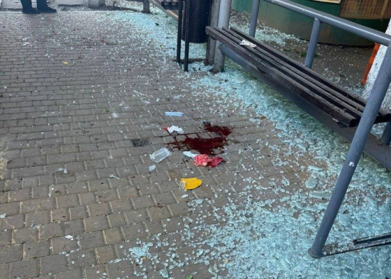 Утренняя атака на Одессу: пострадали три человека, одна женщина — в тяжелом состоянии (фото)