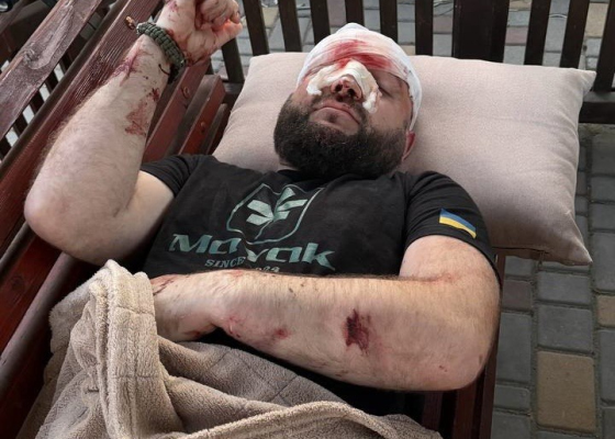 Перелом руки и носа: на Одесичине военного избили арматурой из-за замечания о российской музыке